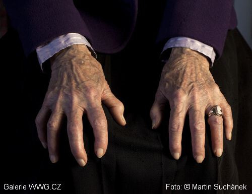 Ruce Geraldine Muchové - Foto: &copy; Martin Suchánek 